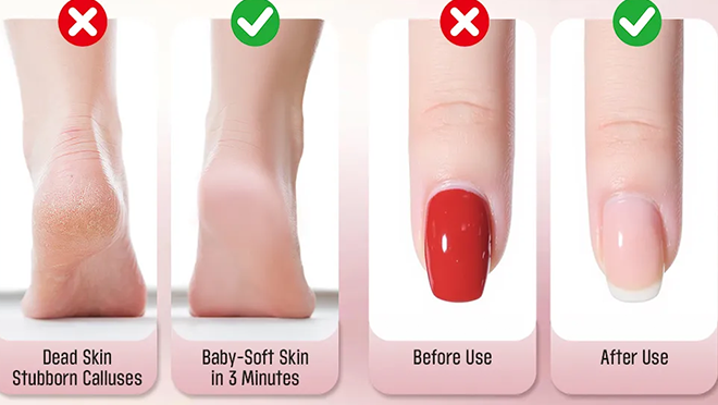 https://yangao.huaqiutong.com/wp-content/uploads/2026/02/Callus-Remover-details-4.webp