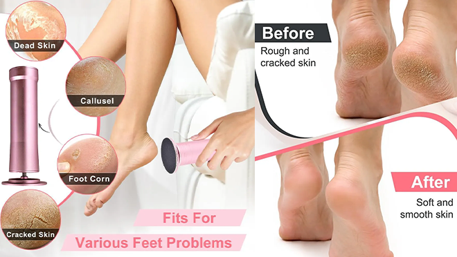 https://yangao.huaqiutong.com/wp-content/uploads/2026/02/Foot-Grinder-details-4.webp