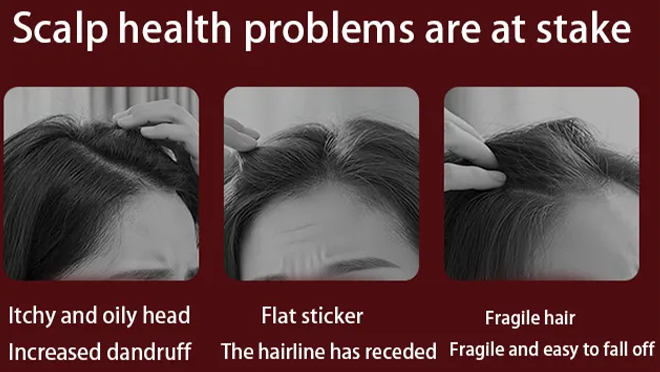 https://yangao.huaqiutong.com/wp-content/uploads/2026/02/Hair-details-5.webp